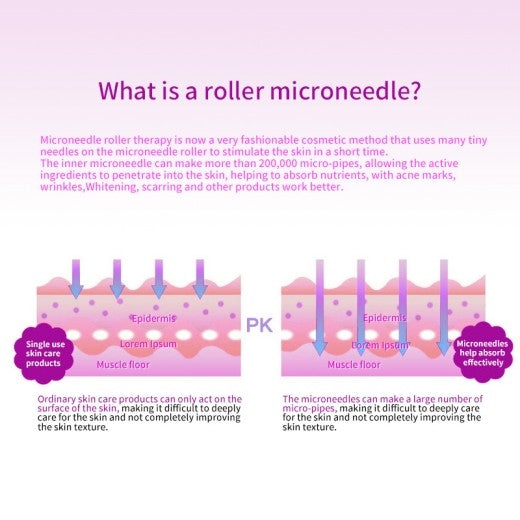 540 Needles Derma Roller 1MM