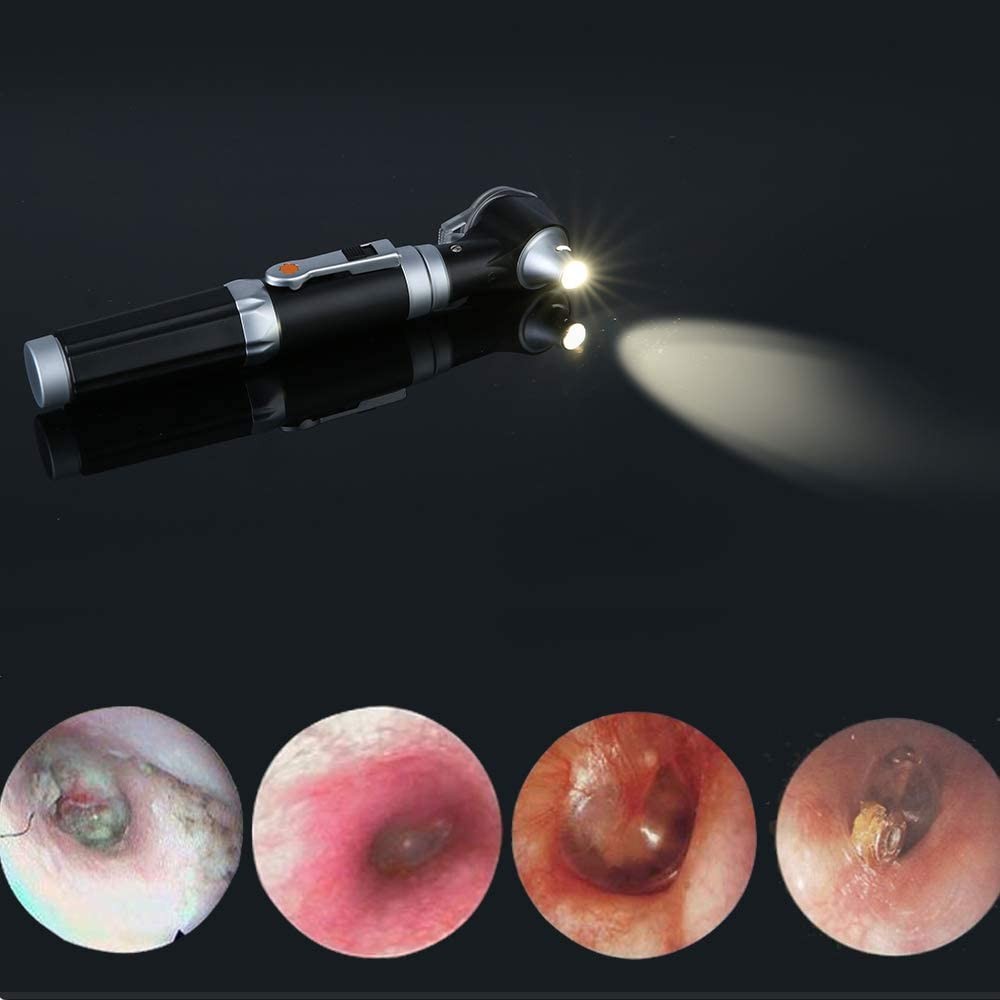 Magnifying Ear Scope with LED Direct Illumination Light