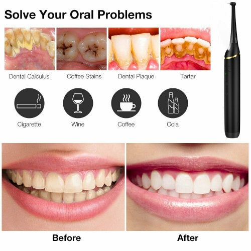 Electric Dental Calculus Remover Tartar Scaler Scraper Tooth Cleaner New